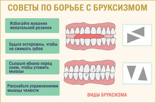 Почему ребенок скрипит зубами во сне Ночные стуки скрежет зубами являют собой неконтролируемое сокращение жевательных мускул вызывающих смыкание челюстей