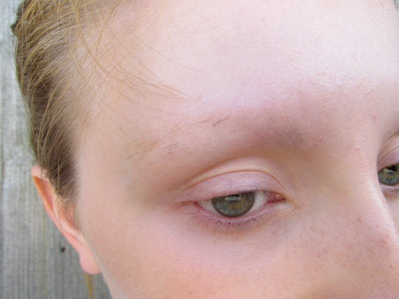 Трихотилломания — болезнь, от которой страдают ресницы и волосы