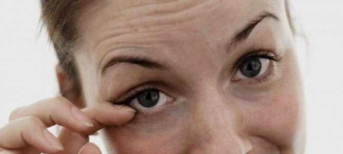 Нервный тик глаза: причины и лечение у взрослых и детей