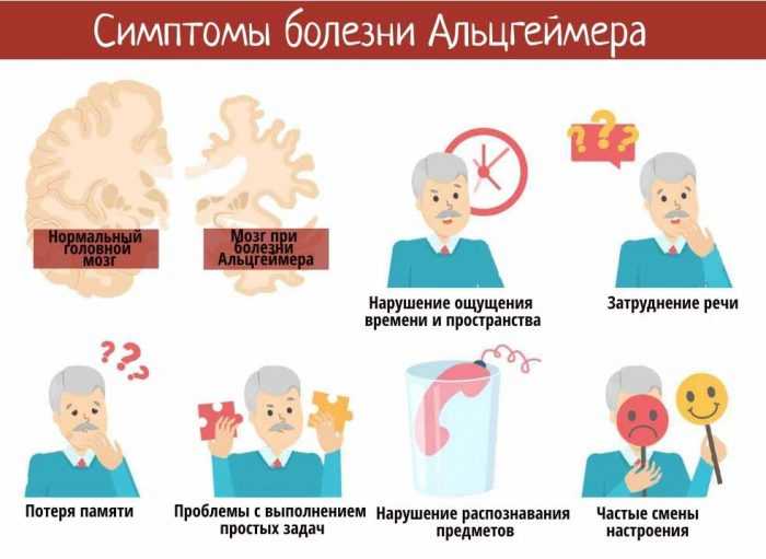 Все об альцгеймере: симптомы, диагностика, факторы риска, лечение