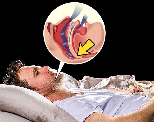 Задыхаться во сне: причины нехватки воздуха ночью, почему тяжело дышать