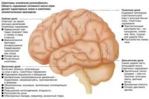 Атрофия коры головного мозга - клиника нейровита