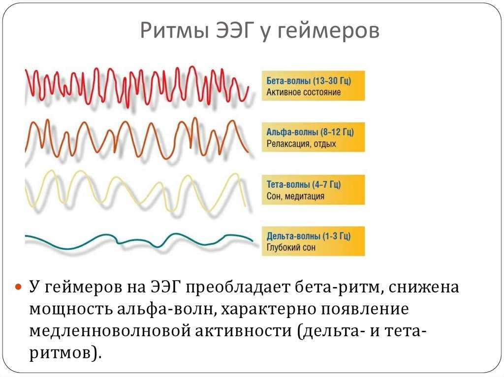 Волны мозга: пять частотных диапазонов работы органа