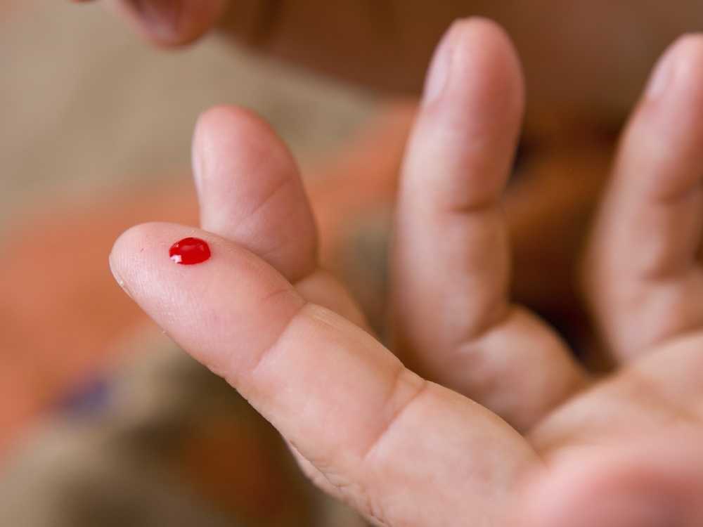 Боязнь крови (гемофобия): что это такое, причины, как перестать бояться