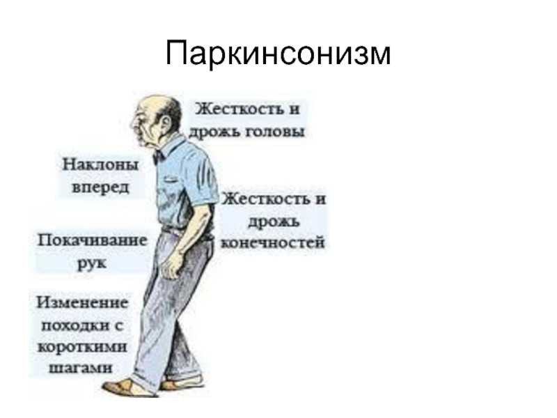 Сосудистый паркинсонизм: причины, симптомы, принципы лечения