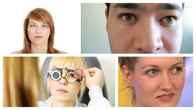Косые глаза: косоглазие у взрослых, причины возникновения, симптомы вертикального, признаки небольшого, что делать с приобретенным