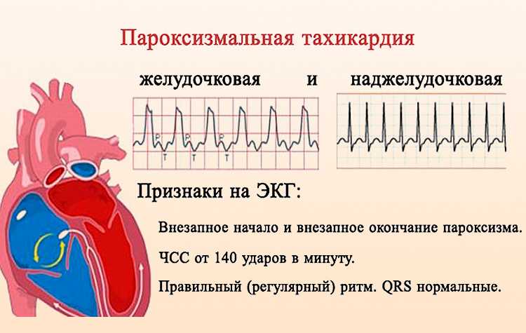 Внутренняя дрожь в теле и сердцебиение: что это такое? основные причины, советы кардиолога