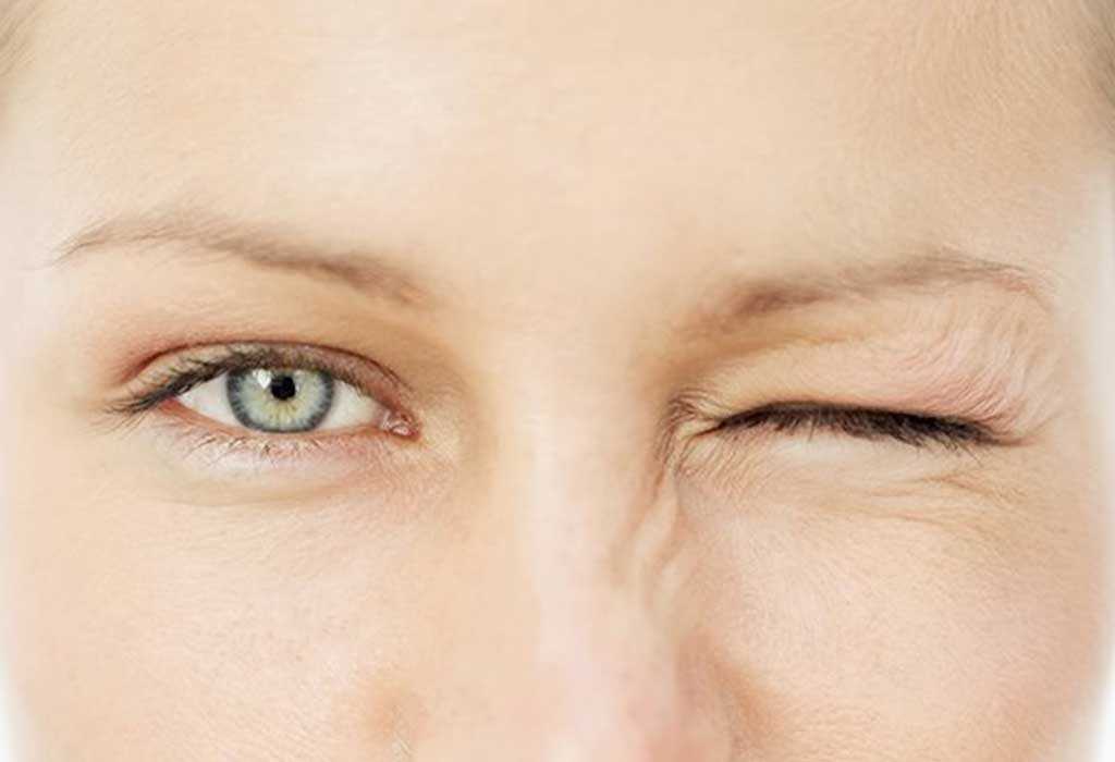 Нервный тик глаза и других частей тела: причины и лечение у детей и взрослых