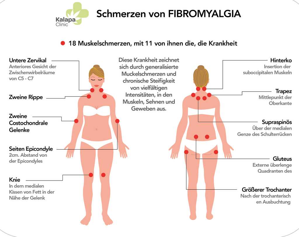 Фибромиалгия: симптомы и эффективное лечение