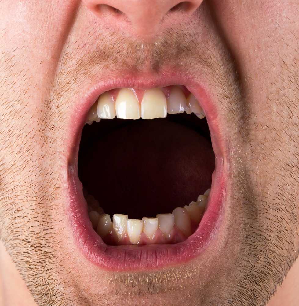 Привкус и горечь лекарства во рту после лечения зуба