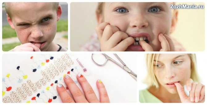 Ребенок грызет ногти - что делать, как отучить ребенка грызть ногти на руках | mamaschool
