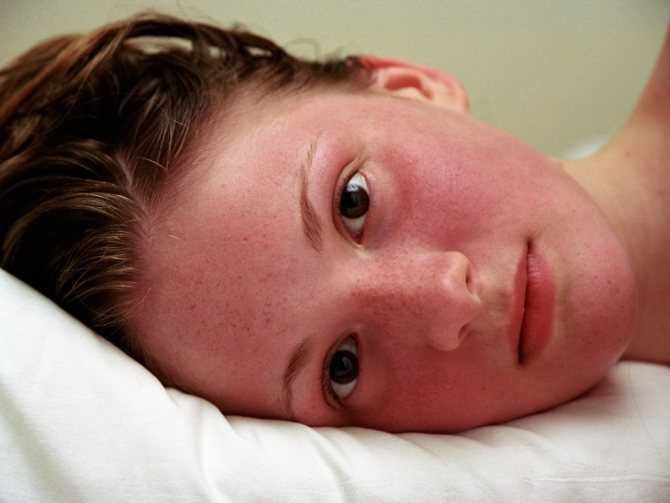 Эритрофобия: жизнь с красным лицом. симптомы, лечение.