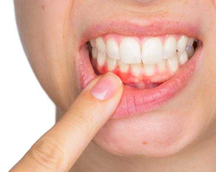 Металлический привкус во рту – все о проблеме: причины возникновения и способы диагностики
