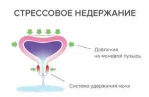 Невроз мочевого пузыря — причины, симптомы и лечение - kardiobit.ru