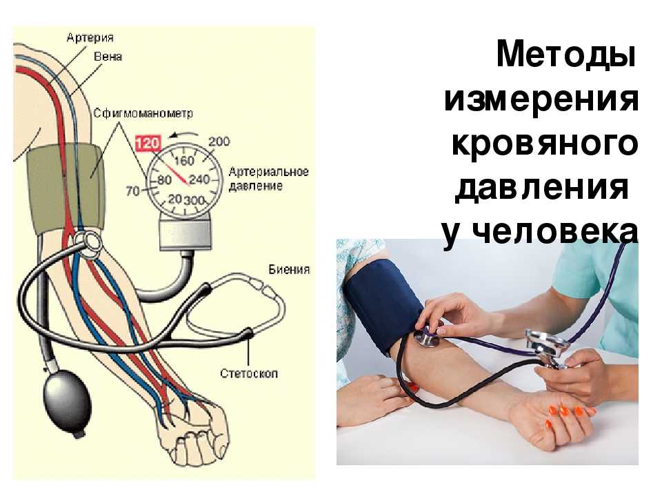 Фобия измерения артериального давления - я гипертоник