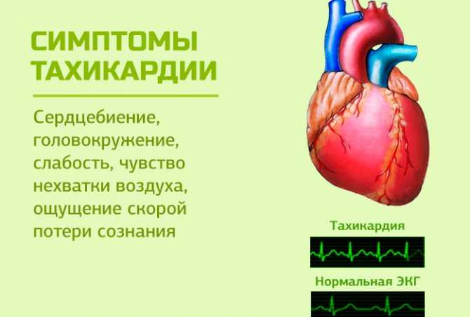 Учащенное сердцебиение и тревога: причины, симптомы, и лечение