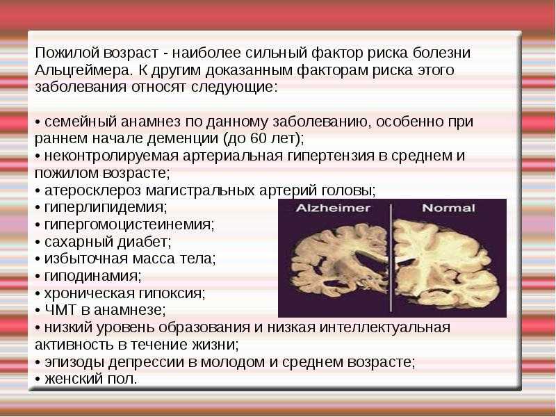 Рубрика “болезнь альцгеймера”