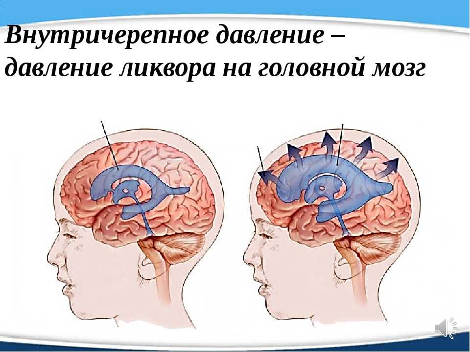 Внутричерепное давление головного мозга