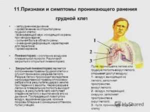 Панические атаки, защемление нерва, закладывает уши и тахикардия при остеохондрозе | все про остеохондроз